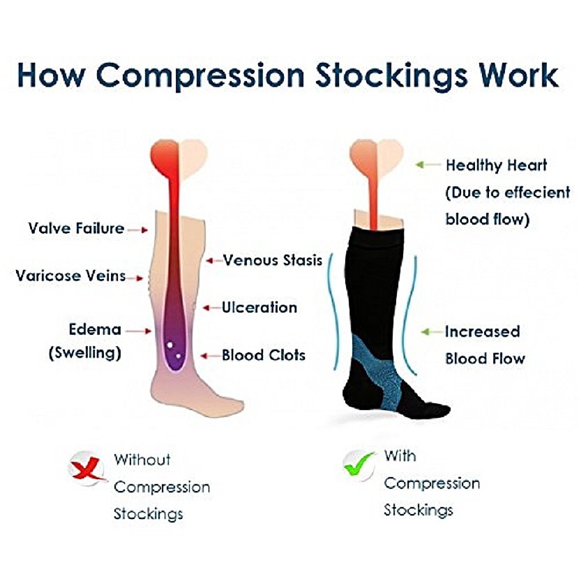 2 Pairs Womens Graduated Mild COMPRESSION 10-15 mmHg Over The Calf Black Socks